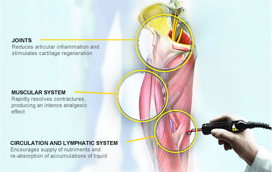 hip-joint