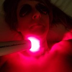 Laser Therapy